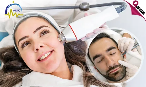 Radio Frequency Microneedling Skin Treatment for Ladies & Men!